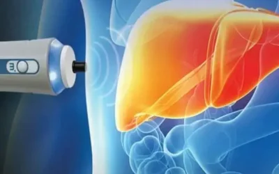 FibroScan: A Non-Invasive Way To Monitor Liver Health