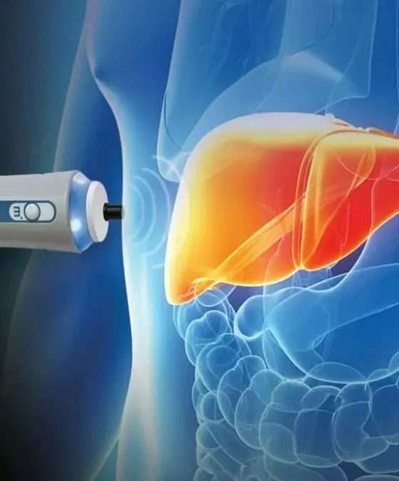 FibroScan: A Non-Invasive Way To Monitor Liver Health