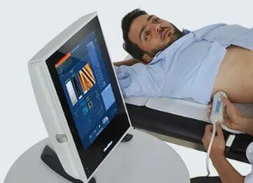 fibroscan