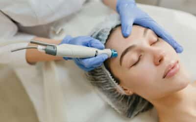 How To Naturally Boost Hyaluronic Acid With Microneedling In Winnipeg