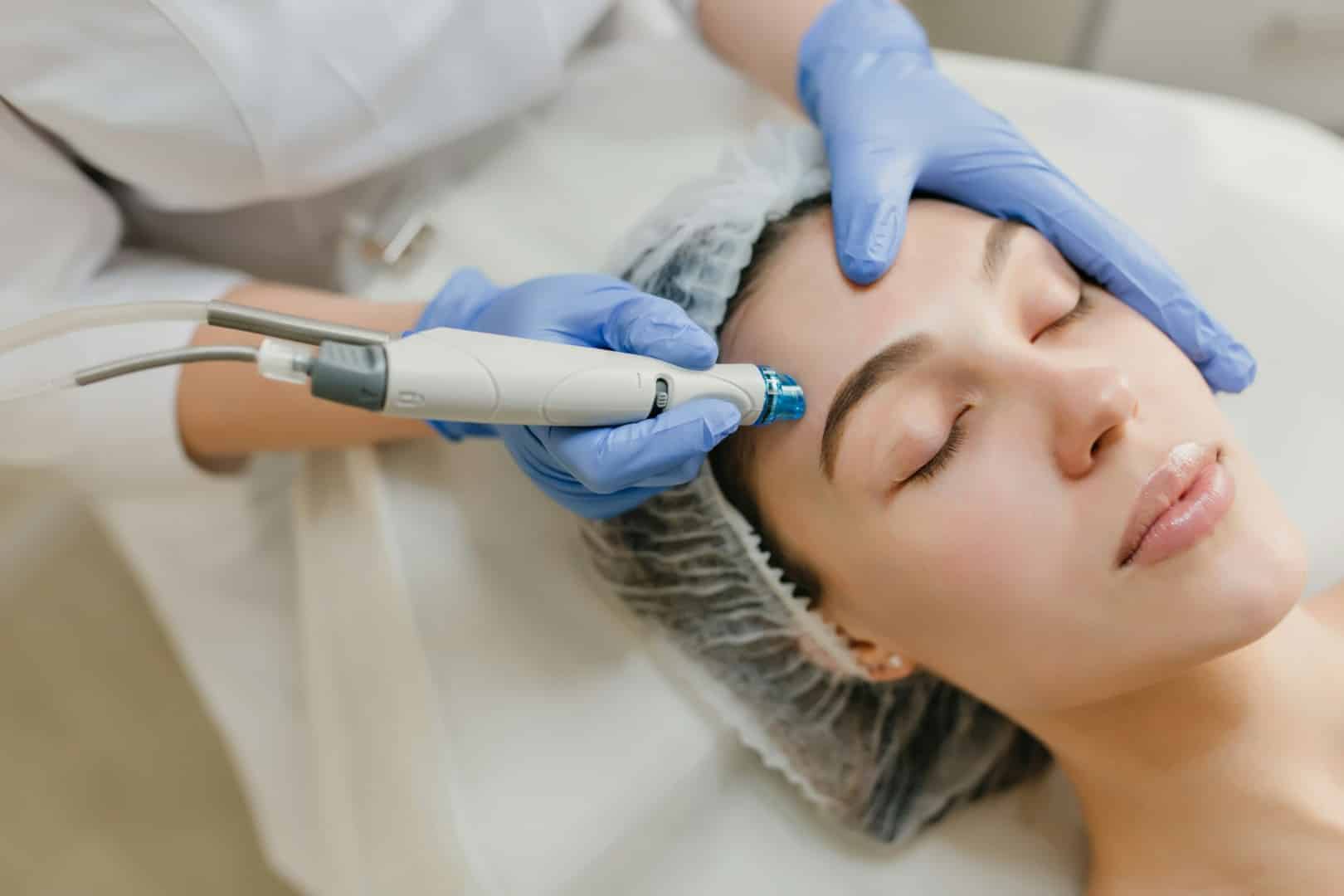 body-measure-micro-needling-winnipeg woman getting micro needling in Winnipeg