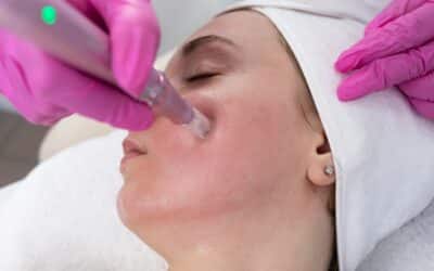 Exion RF Microneedling Vs. Morpheus8: Which Is Better For Skin Tightening?